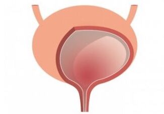 vezica urinară și întărirea capsulelor de organe femixal